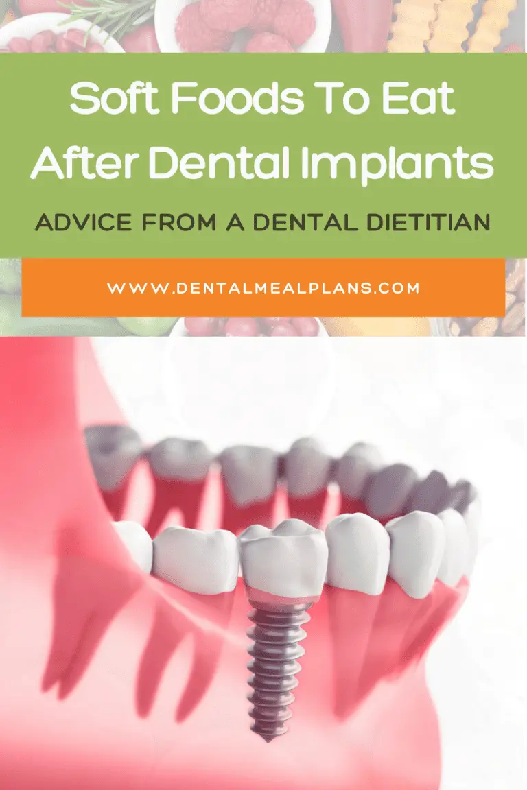 Soft Foods To Eat After Dental Implants Advice From A Dental Dietitian Dental Meal Plans 