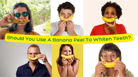 Should you use a banana peel to whiten teeth?