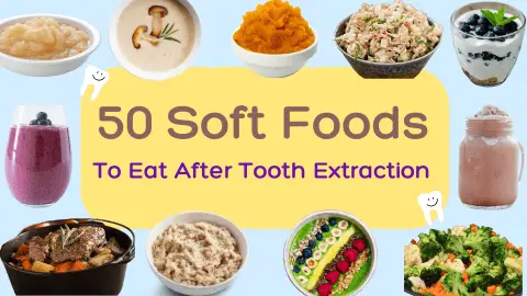 50 food soft foods to eat after tooth extraction