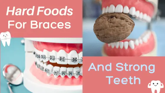 hard foods for braces and strong teeth