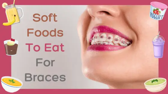 Soft foods to eat for braces