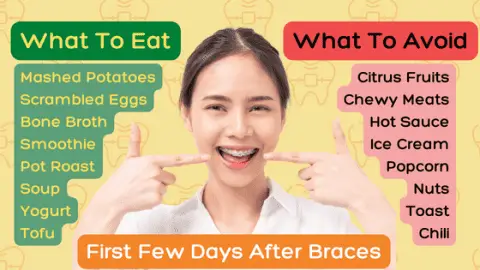 Soft Foods To Eat For Braces [Free Sample Meal Plan] - Dental Meal Plans