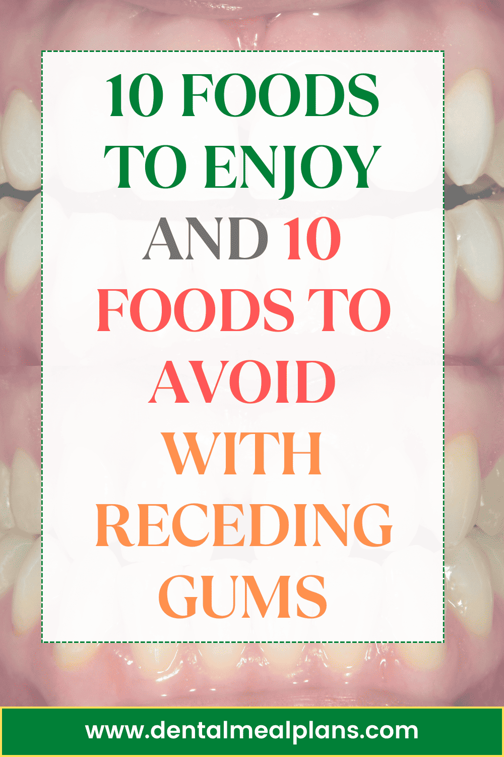 10 foods to enjoy and 10 foods to avoid with receding gums