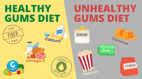 healthy gums diet and unhealthy gums diet